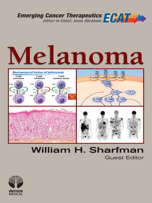 cover image of Melanoma